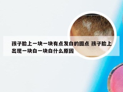 孩子脸上一块一块有点发白的圆点 孩子脸上出现一块白一块白什么原因