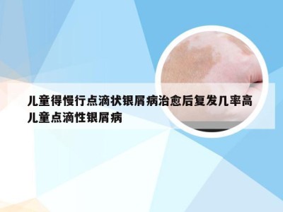 儿童得慢行点滴状银屑病治愈后复发几率高 儿童点滴性银屑病