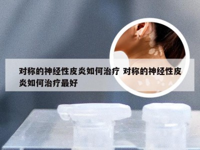 对称的神经性皮炎如何治疗 对称的神经性皮炎如何治疗最好