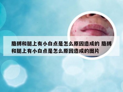 胳膊和腿上有小白点是怎么原因造成的 胳膊和腿上有小白点是怎么原因造成的图片