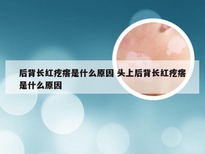 后背长红疙瘩是什么原因 头上后背长红疙瘩是什么原因