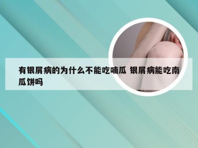 有银屑病的为什么不能吃喃瓜 银屑病能吃南瓜饼吗