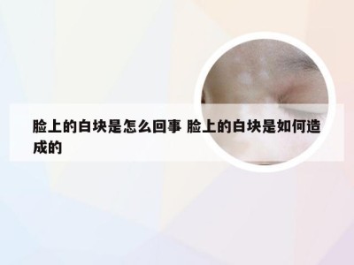 脸上的白块是怎么回事 脸上的白块是如何造成的