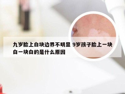 九岁脸上白块边界不明显 9岁孩子脸上一块白一块白的是什么原因