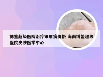 博鳌超级医院治疗银屑病价格 海南博鳌超级医院皮肤医学中心