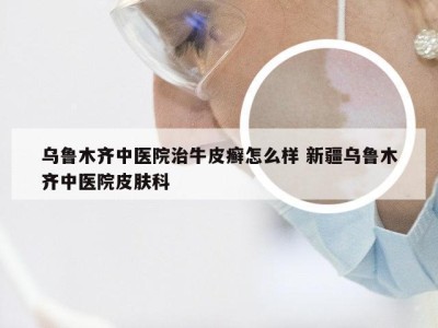 乌鲁木齐中医院治牛皮癣怎么样 新疆乌鲁木齐中医院皮肤科