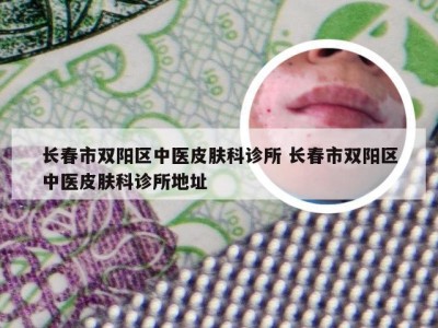 长春市双阳区中医皮肤科诊所 长春市双阳区中医皮肤科诊所地址