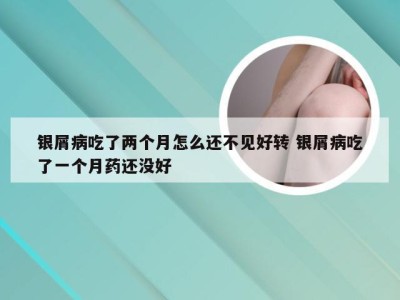 银屑病吃了两个月怎么还不见好转 银屑病吃了一个月药还没好