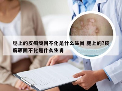 腿上的皮癣顽固不化是什么生肖 腿上的?皮癣顽固不化是什么生肖