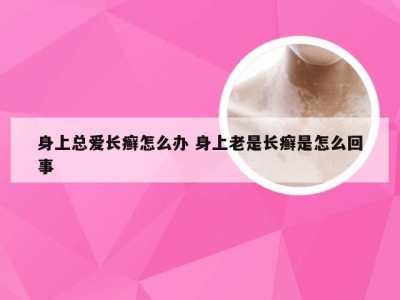 身上总爱长癣怎么办 身上老是长癣是怎么回事