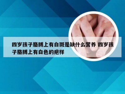 四岁孩子胳膊上有白斑是缺什么营养 四岁孩子胳膊上有白色的疤样