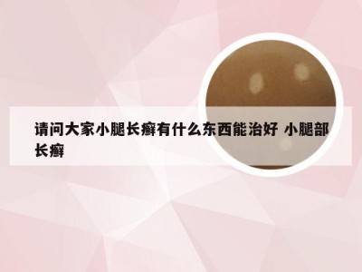 请问大家小腿长癣有什么东西能治好 小腿部长癣