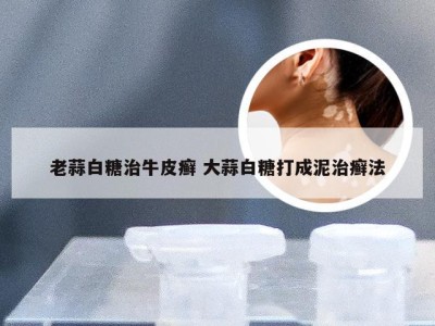 老蒜白糖治牛皮癣 大蒜白糖打成泥治癣法