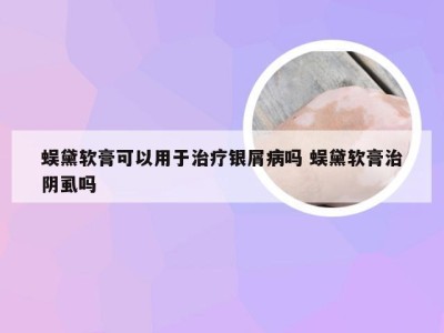 蜈黛软膏可以用于治疗银屑病吗 蜈黛软膏治阴虱吗