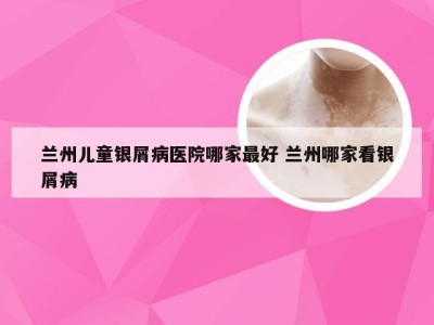 兰州儿童银屑病医院哪家最好 兰州哪家看银屑病