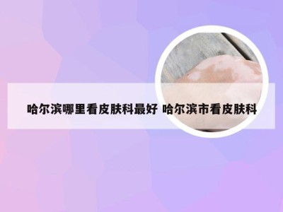 哈尔滨哪里看皮肤科最好 哈尔滨市看皮肤科