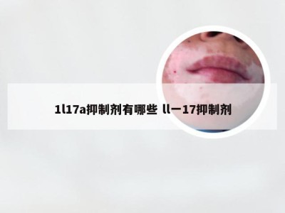 1l17a抑制剂有哪些 ll一17抑制剂