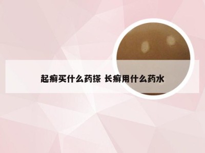 起癣买什么药搽 长癣用什么药水