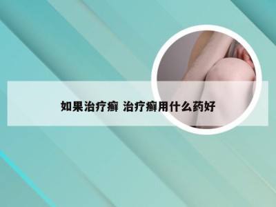 如果治疗癣 治疗癣用什么药好