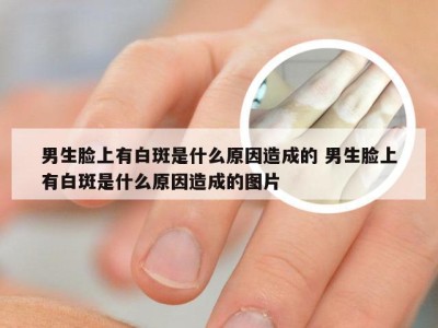 男生脸上有白斑是什么原因造成的 男生脸上有白斑是什么原因造成的图片