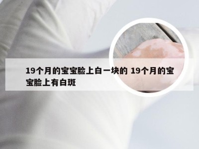 19个月的宝宝脸上白一块的 19个月的宝宝脸上有白斑