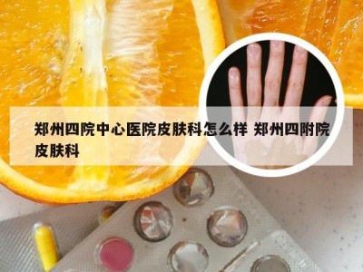 郑州四院中心医院皮肤科怎么样 郑州四附院皮肤科