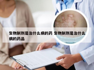 生物制剂是治什么病的药 生物制剂是治什么病的药品