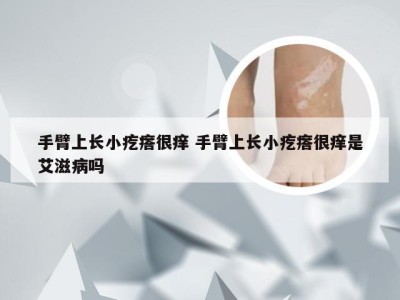 手臂上长小疙瘩很痒 手臂上长小疙瘩很痒是艾滋病吗