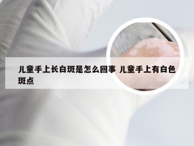 儿童手上长白斑是怎么回事 儿童手上有白色斑点