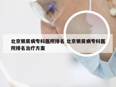 北京银屑病专科医院排名 北京银屑病专科医院排名治疗方案