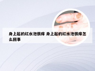 身上起的红水泡很痒 身上起的红水泡很痒怎么回事