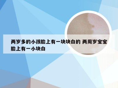 两岁多的小孩脸上有一块块白的 两周岁宝宝脸上有一小块白