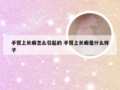 手臂上长癣怎么引起的 手臂上长癣是什么样子