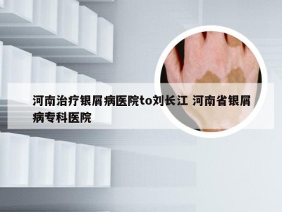 河南治疗银屑病医院to刘长江 河南省银屑病专科医院