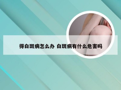 得白斑病怎么办 白斑病有什么危害吗