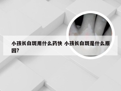 小孩长白斑用什么药快 小孩长白斑是什么原因?