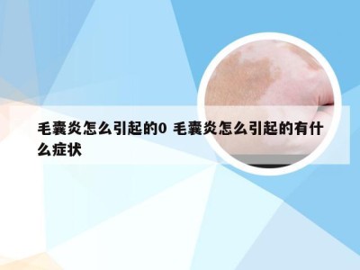 毛囊炎怎么引起的0 毛囊炎怎么引起的有什么症状