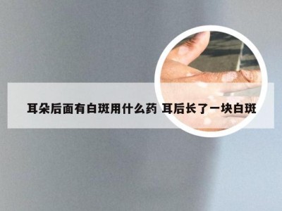 耳朵后面有白斑用什么药 耳后长了一块白斑