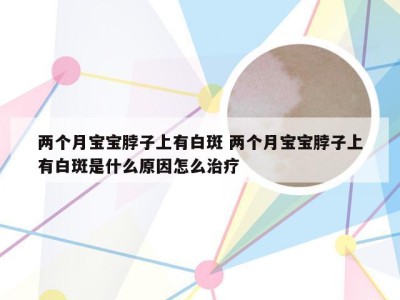 两个月宝宝脖子上有白斑 两个月宝宝脖子上有白斑是什么原因怎么治疗