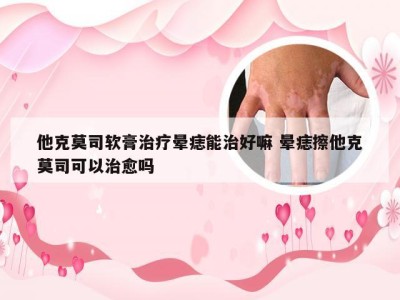 他克莫司软膏治疗晕痣能治好嘛 晕痣擦他克莫司可以治愈吗