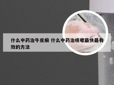 什么中药治牛皮癣 什么中药治咳嗽最快最有效的方法