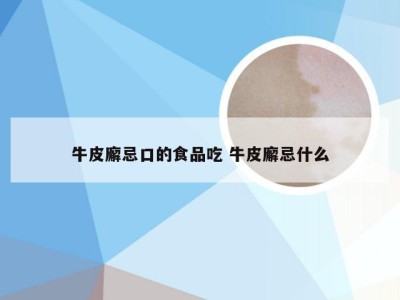 牛皮廨忌口的食品吃 牛皮廨忌什么