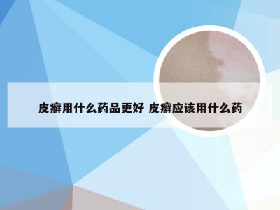 皮癣用什么药品更好 皮癣应该用什么药