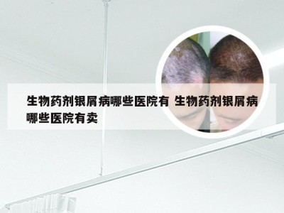 生物药剂银屑病哪些医院有 生物药剂银屑病哪些医院有卖