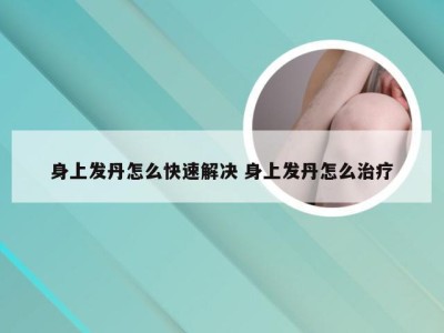 身上发丹怎么快速解决 身上发丹怎么治疗