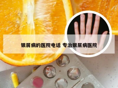 银屑病的医院电话 专治银屑病医院