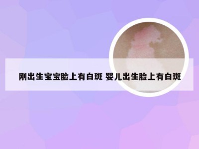 刚出生宝宝脸上有白斑 婴儿出生脸上有白斑