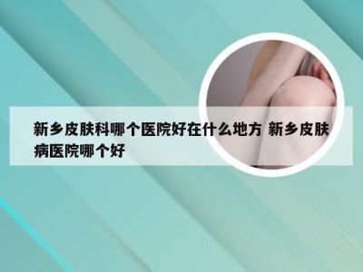 新乡皮肤科哪个医院好在什么地方 新乡皮肤病医院哪个好