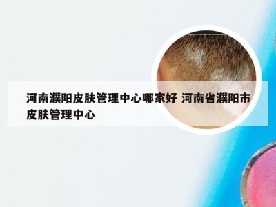 河南濮阳皮肤管理中心哪家好 河南省濮阳市皮肤管理中心