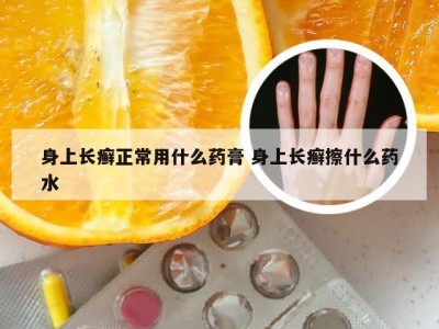 身上长癣正常用什么药膏 身上长癣擦什么药水